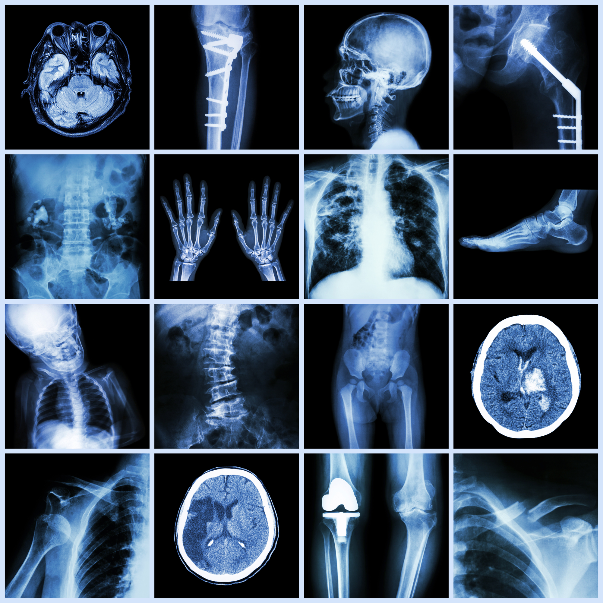 x ray and imaging centre in yelahanka call 8147282686